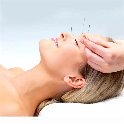 best acupuncture perth|Top 10 Best Acupuncture Near Perth, Western Australia .